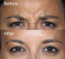 Before & After Photos